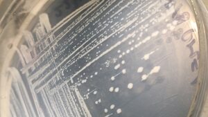 Lee más sobre el artículo Aislaron una bacteria que “come” hidrocarburos y es capaz de producir bioplásticos<p class = "resumen">Fue hallada en el puerto de Mar del Plata. La iniciativa recibió financiamiento de la CIC en el marco de la convocatoria a Ideas-Proyecto.</p>